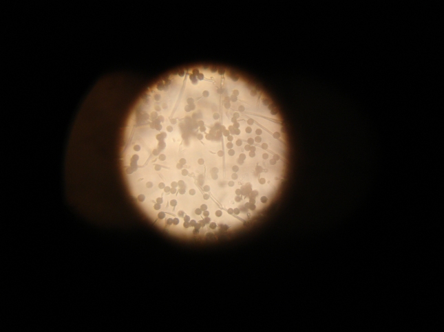 Esporas vistas ao microscopio